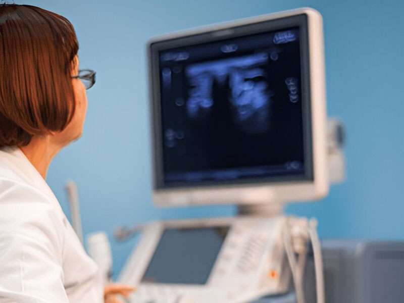 USG (Ultrasound)