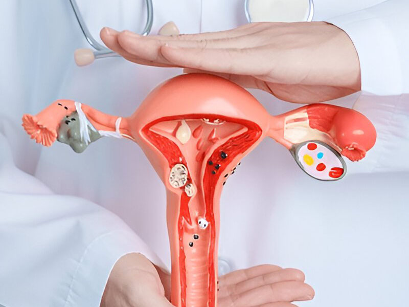 Gynecology